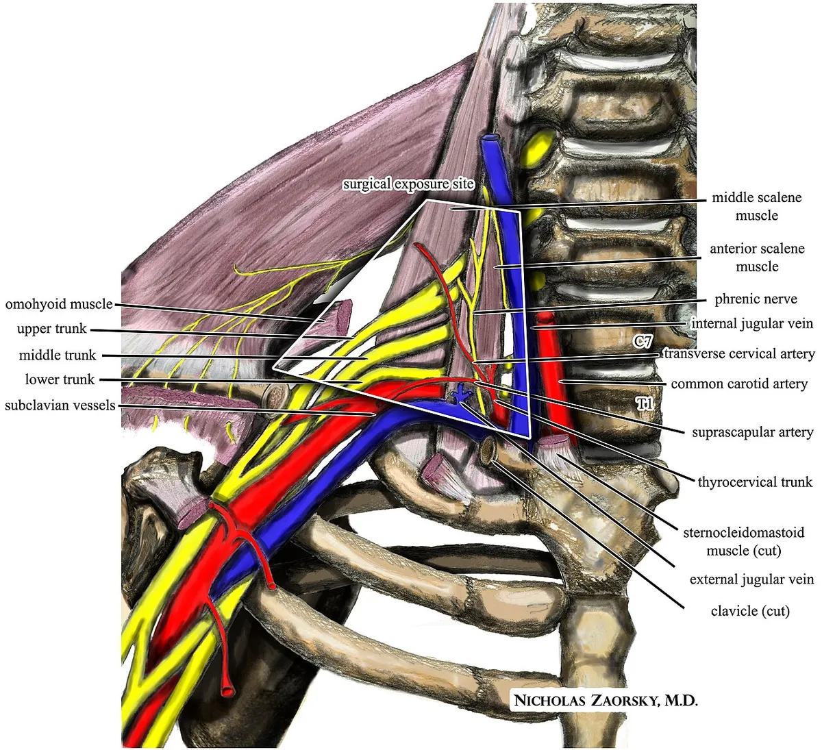 picture of tight nerve bundles