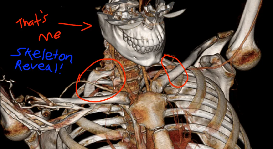 my-actual-skeleton