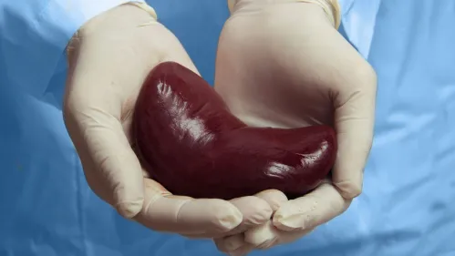 kidney_transplant