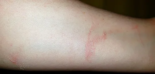 owie.