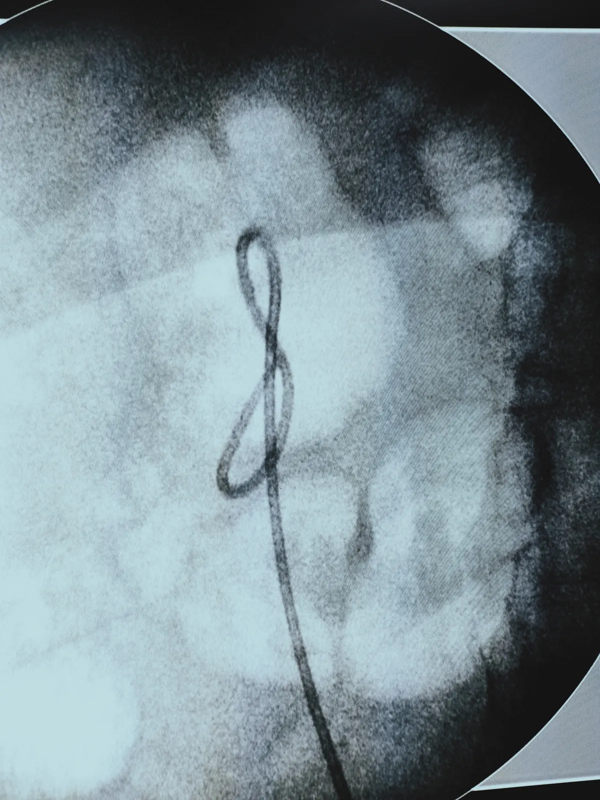 IMG_20260411_153541757