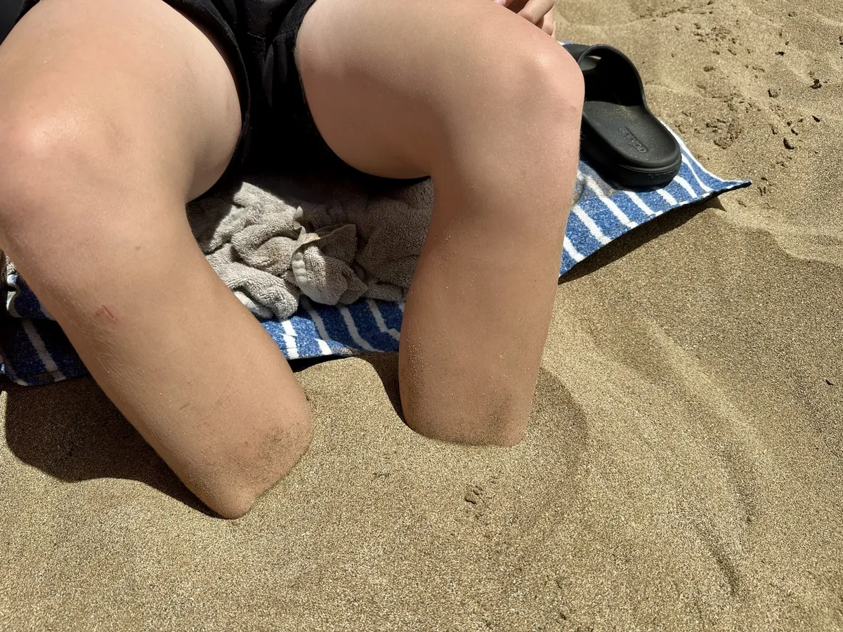 Eine Person sitzt am Strand auf einem Handtuch, wobei ihre Beine bis zu den Knien im Sand vergraben sind.