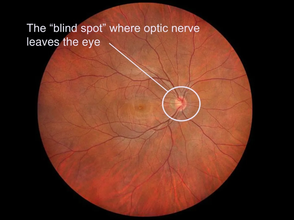 blind spot