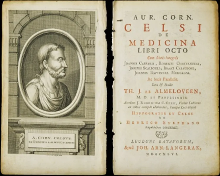 上图：塞尔苏斯（Aulus Cornelius Celsus，主前25-主后50年）编纂的百科全书《医术 De Medicina》。在这本书中提到希腊文称为elephantiasis graecorum的疾病，症状与现代的麻风病相似。但主前3-2世纪的希腊文七十士译本却把「大麻风 צָרַעַת」译为Λέπρα（lepra），意思是「使皮肤有鳞的病」。主后5世纪耶柔米（Jerome）在翻译拉丁文武加大译本时，也没有使用学名elephantiasis graecorum，而是使用lepra的音译，表明他并不认为lepra就是麻风病，而只是一种恶性皮肤病。从lepra转变来的英文leprosy后来被用来称呼「麻风病 Hansen’s Disease」，所以现代人常常把圣经里的「大麻风」误解为现代的「麻风病」。
