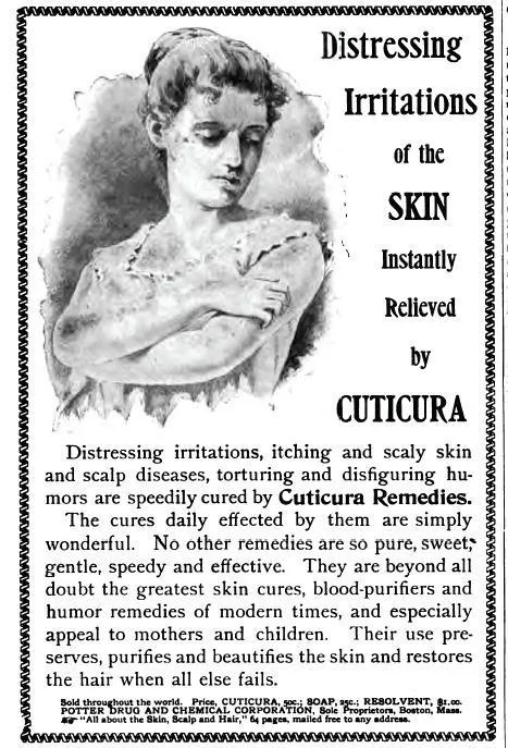 1894 Cuticura Soap advertisement