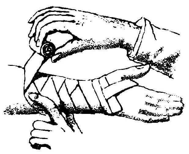 Grierson_90_Vendaje_en_antebrazo