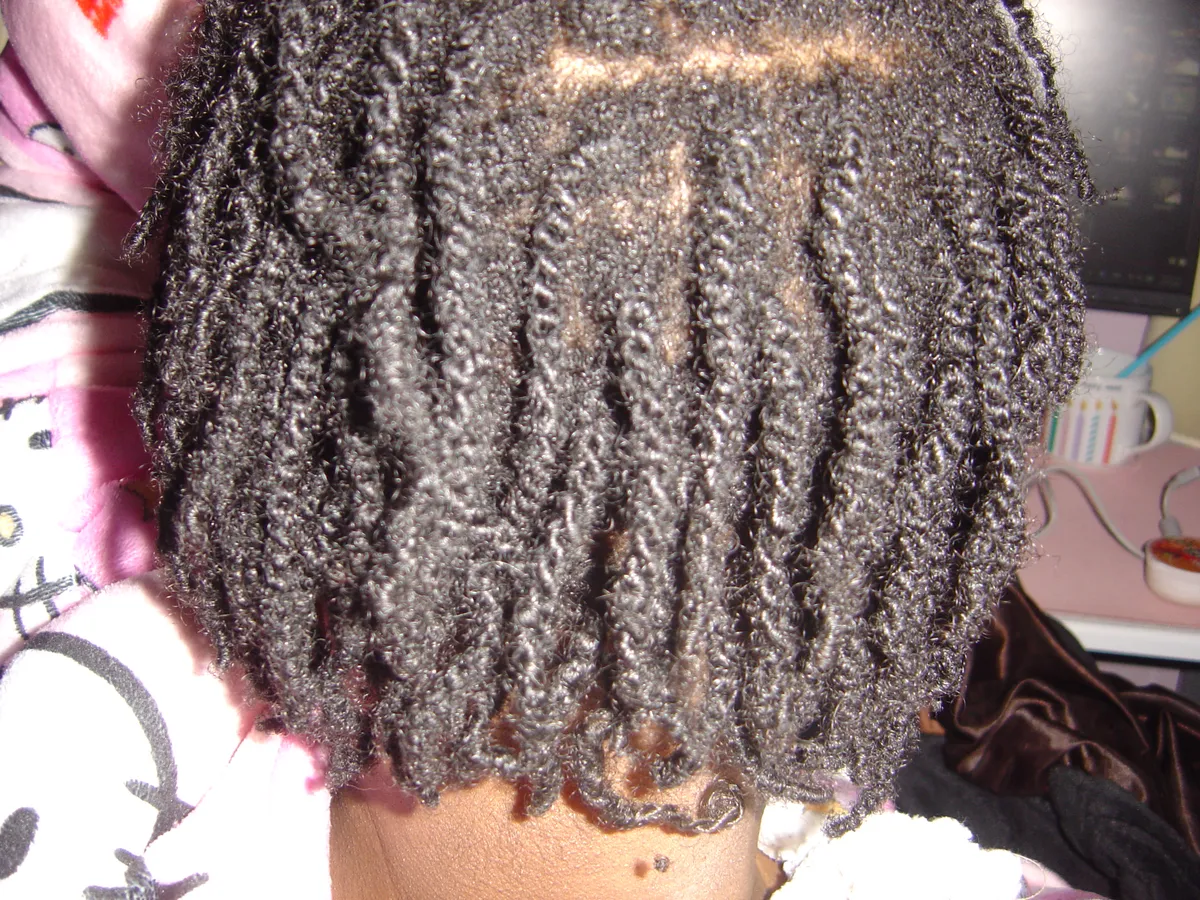 A high-angle, back-view photograph of a person’s head showing a full set of established microloc starter twists. The hair is divided into small, uniform square sections. The twists show some texture and volume from growth, reaching down to the nape of the neck against a pink and white patterned backdrop.